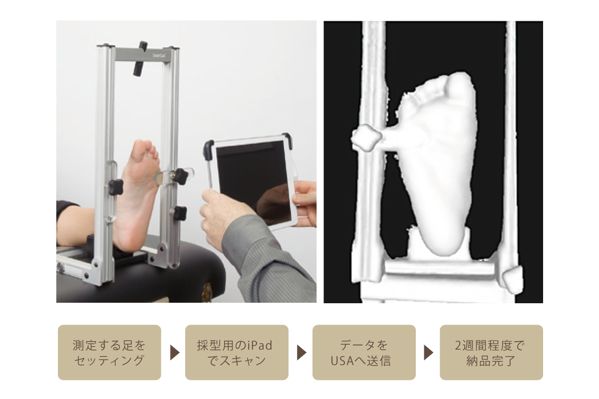 最新3Dスキャニングデバイス「SmartCast®システム」を用いた高精度測定と簡単で清潔な採型プロセス